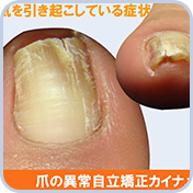 爪の病気、爪の異常